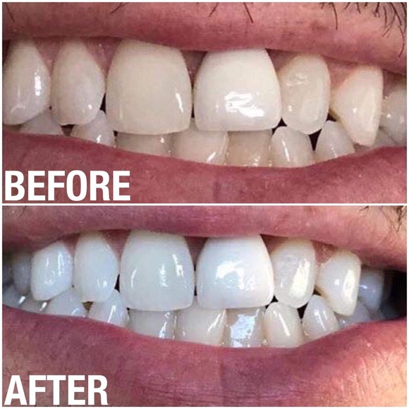 Whitening Toothpaste!! - Picture 3 of 6